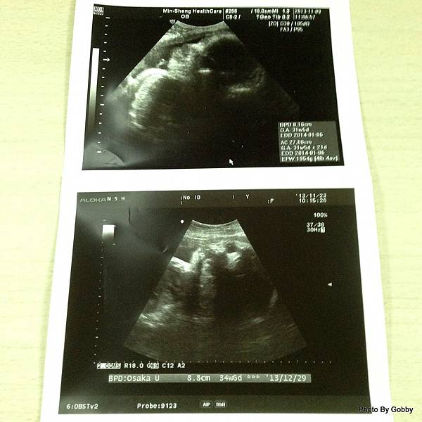 27+3的產檢（孕婦什麼不能吃？楊醫師真風趣） @About Hsuan美美媽咪親子美食旅遊